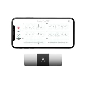 KardiaMobile 6-Lead Personal EKG Monitor – Six Views of The Heart – Detects AFib and Irregular Arrhythmias – Instant Results in 30 Seconds – Works with Most Smartphones – FSA/HSA Eligible